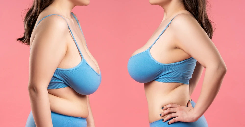 semaglutide breast tenderness Ozempic Breasts” Ozempic Breasts: Signs, Causes, Prevention,