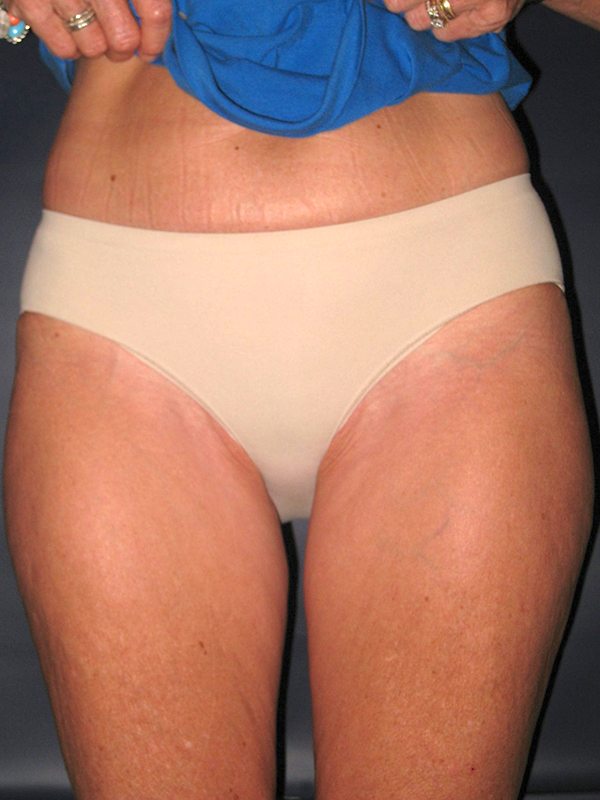  bna image b