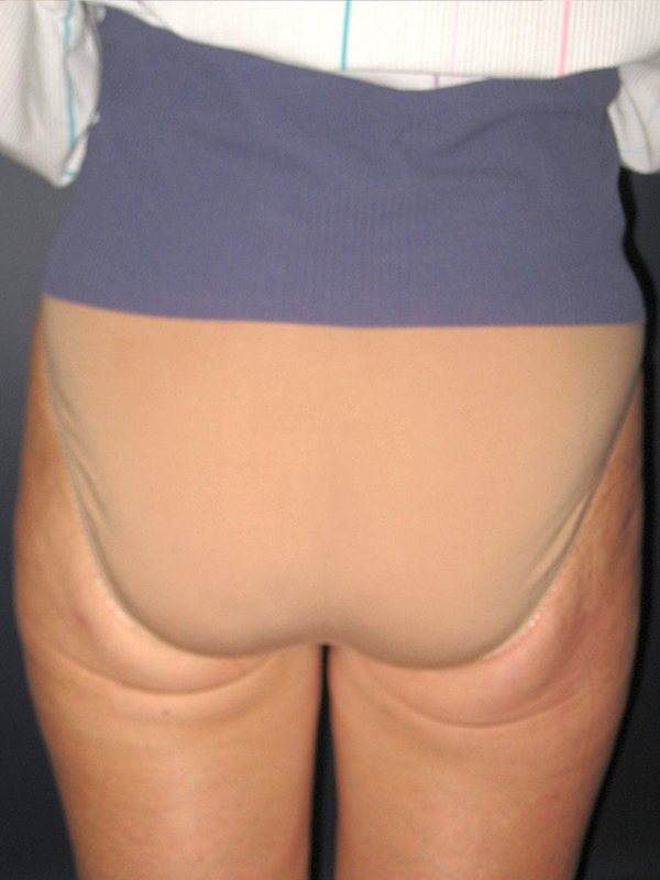 bna image