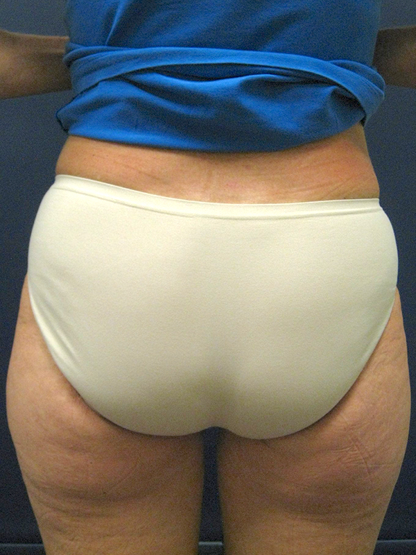  bna image b