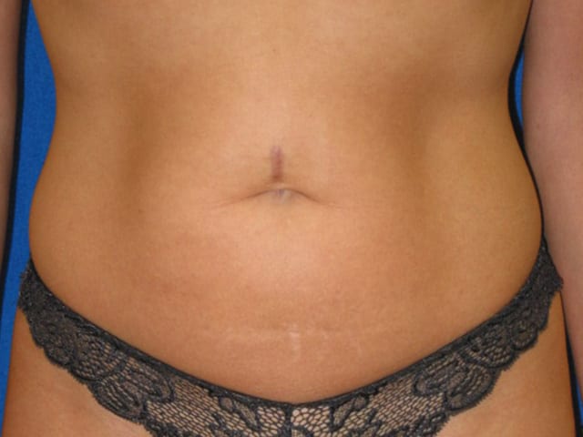  bna image b