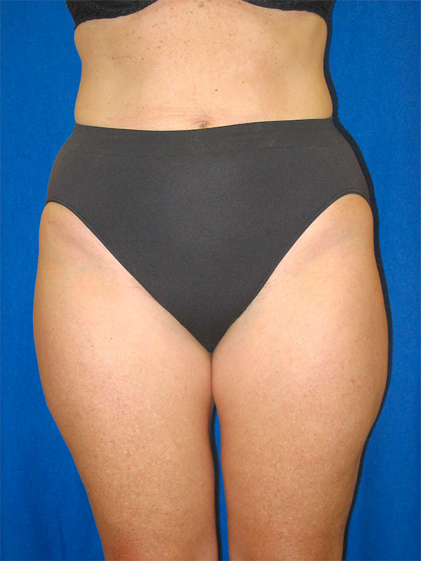 bna image
