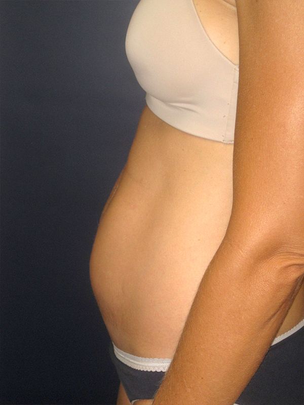  bna image b