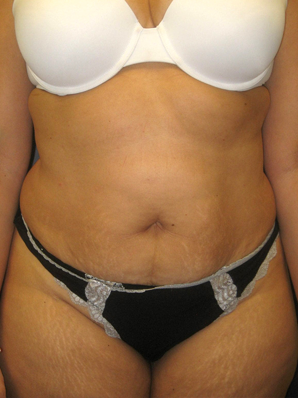  bna image b