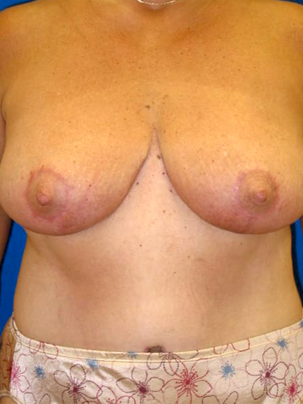 bna image