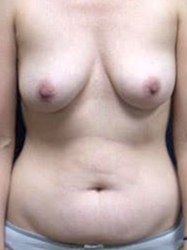  bna image b