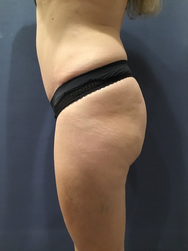 bna image