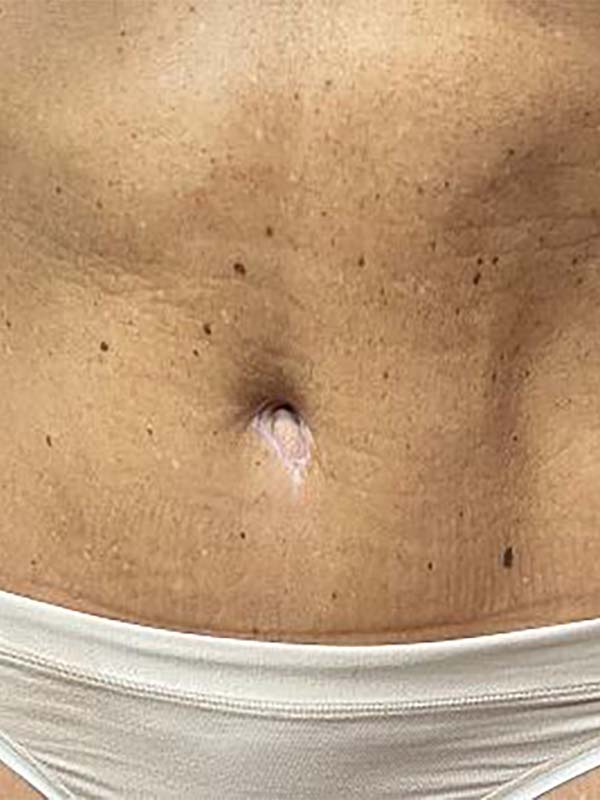 bna image