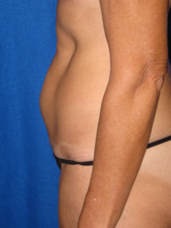  bna image b