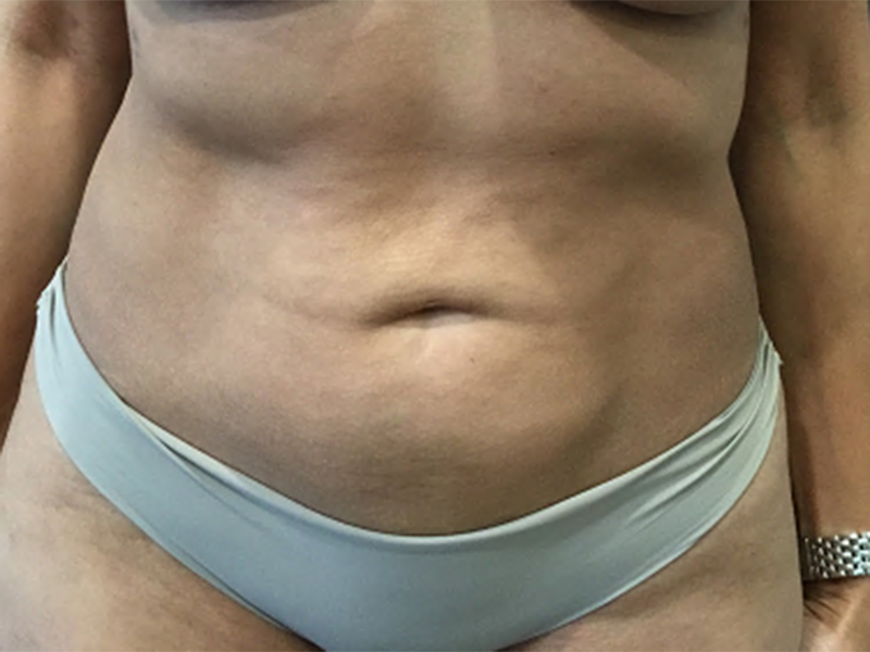  bna image b