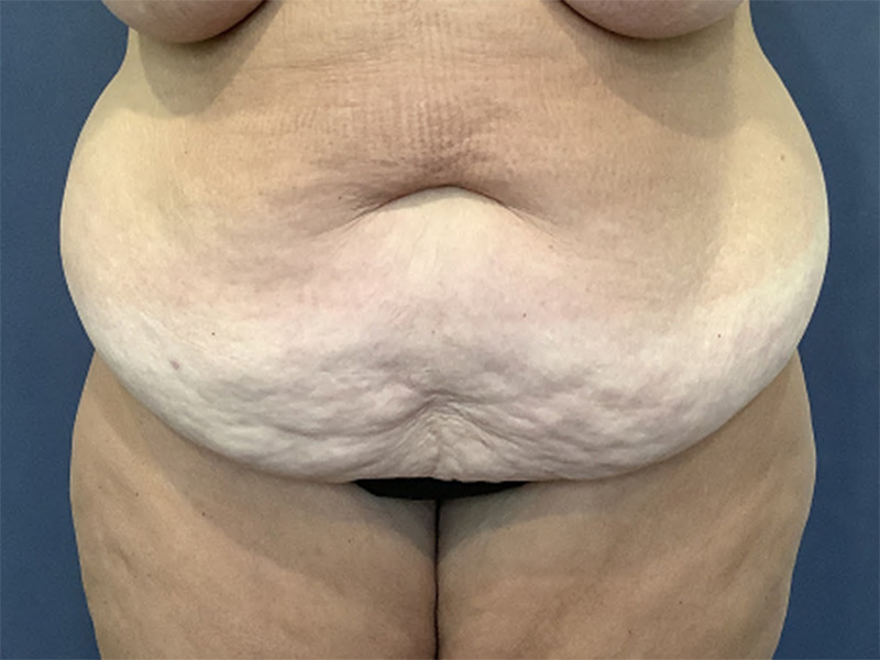  bna image b