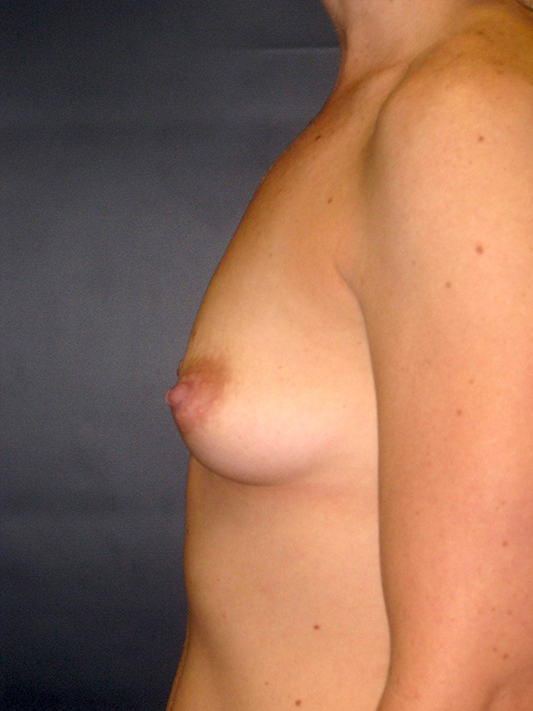  bna image b