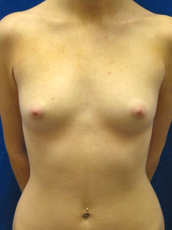  bna image b