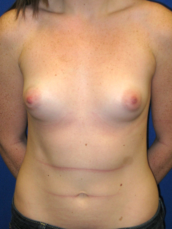  bna image b