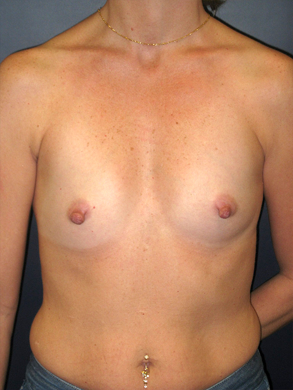  bna image b