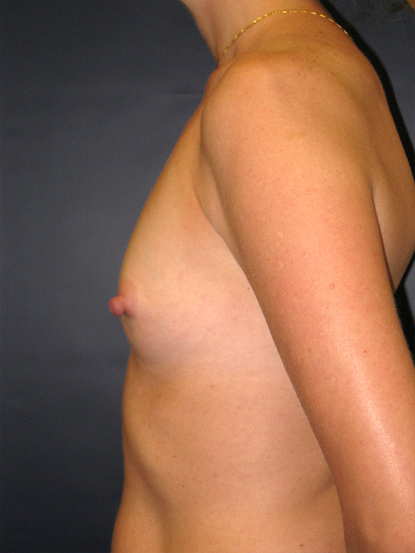  bna image b