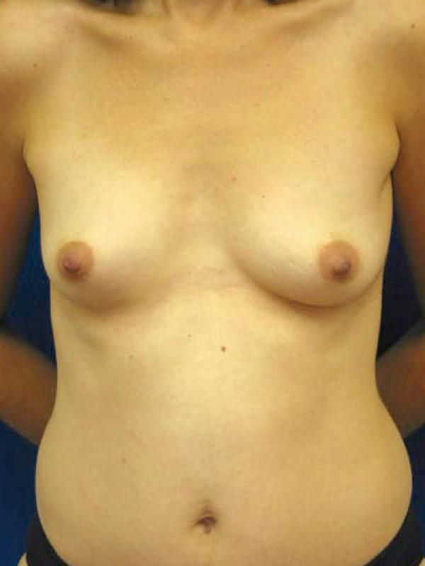 bna image b