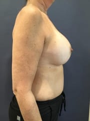 bna image