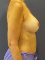  bna image b