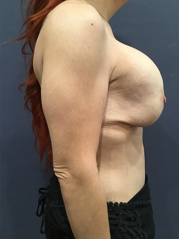 bna image b