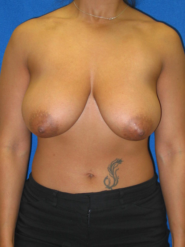  bna image b