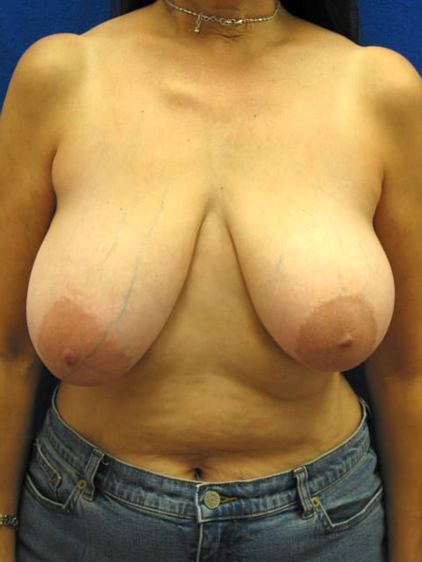  bna image b
