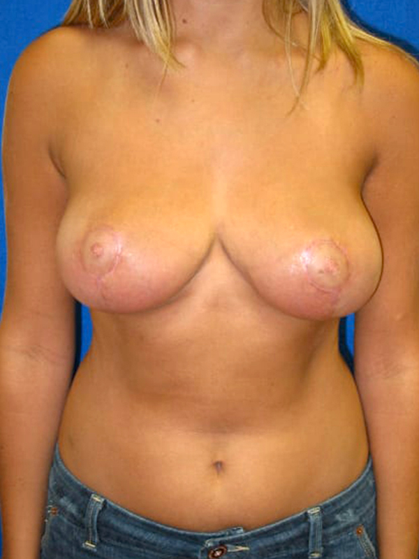 bna image