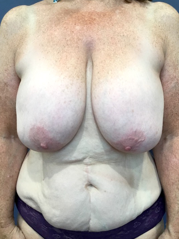  bna image b