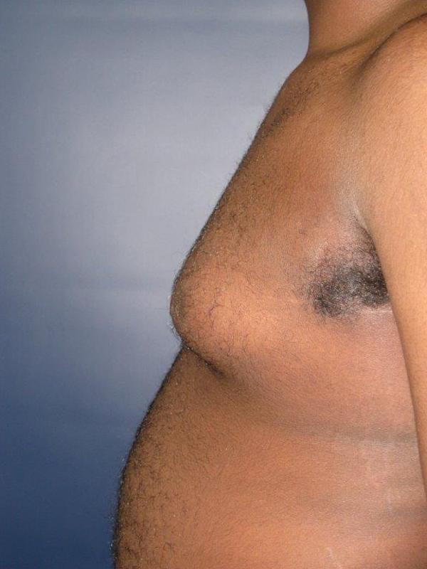  bna image b