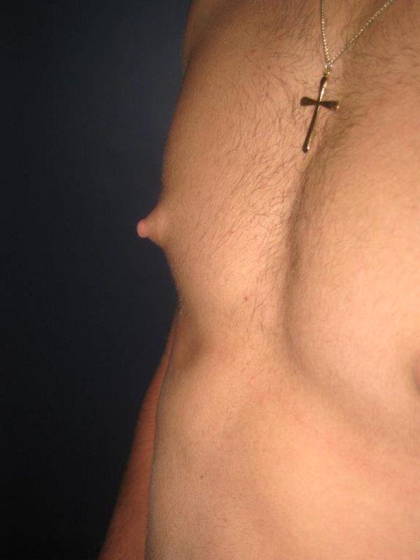  bna image b