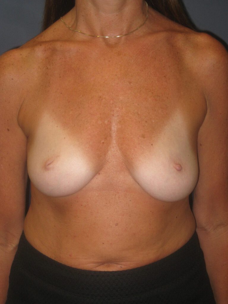  bna image b