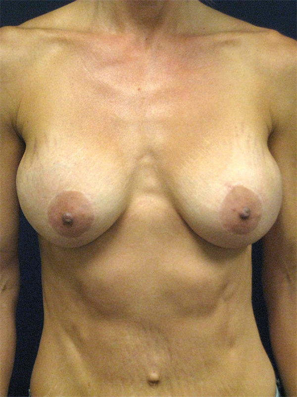 bna image