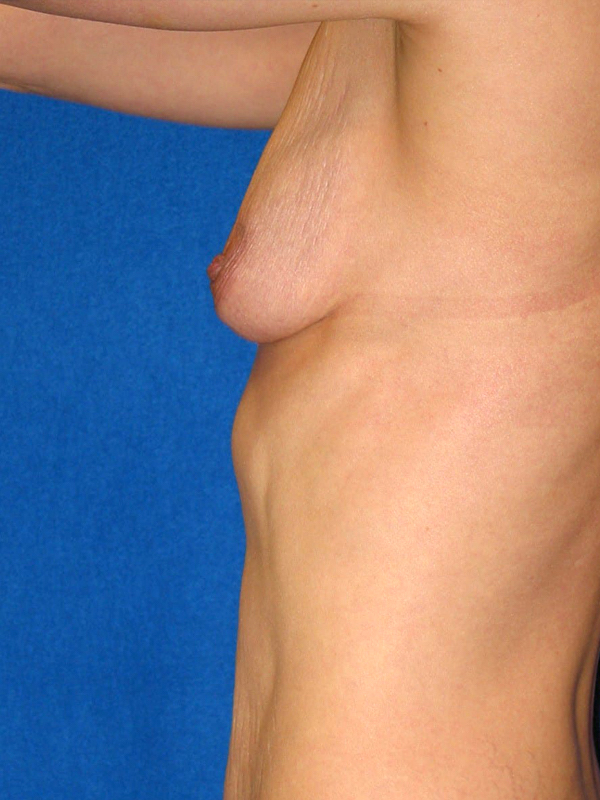  bna image b