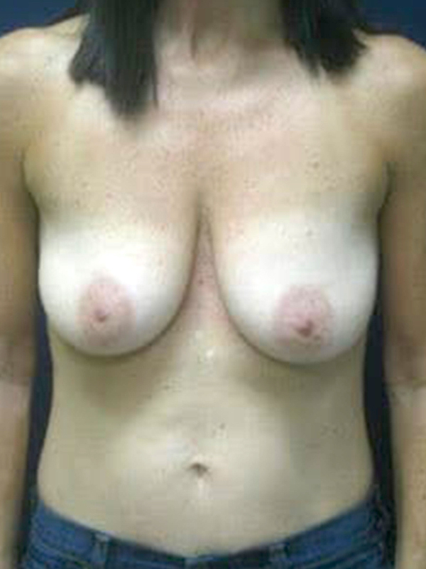  bna image b