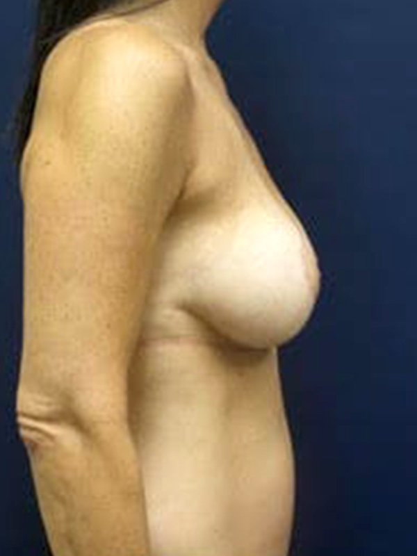bna image