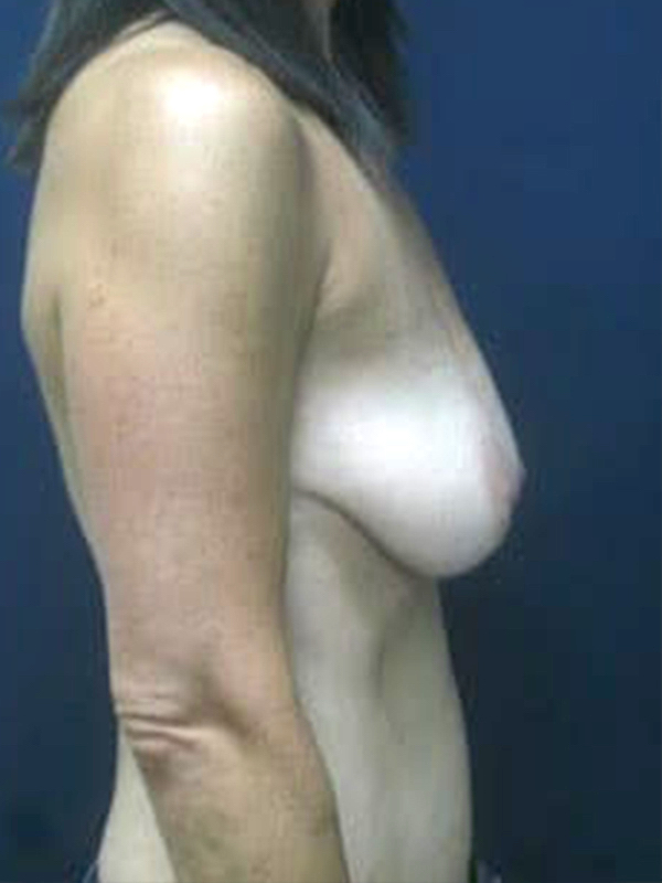  bna image b