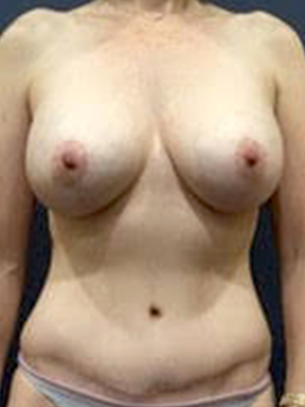 bna image