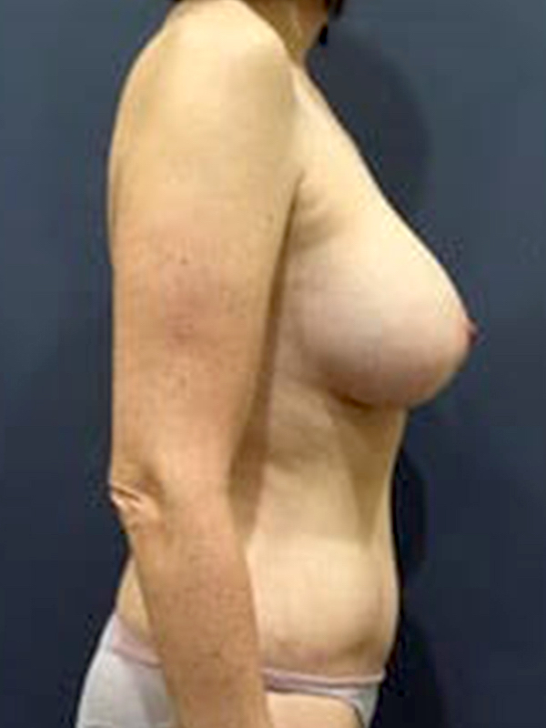 bna image