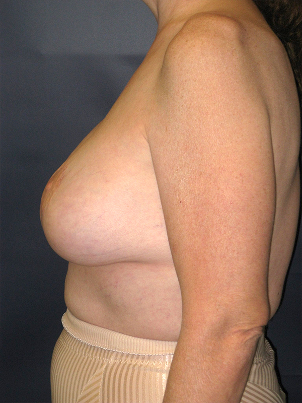 bna image