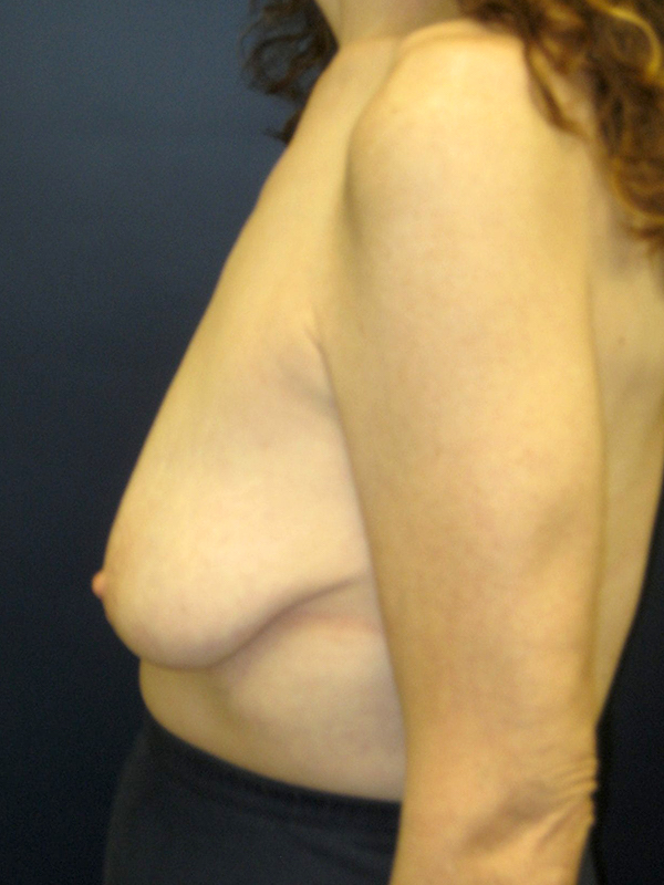  bna image b