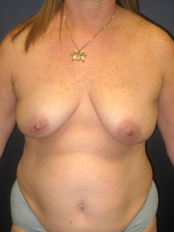  bna image b