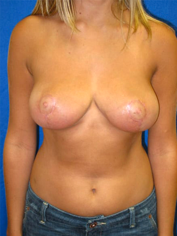 bna image