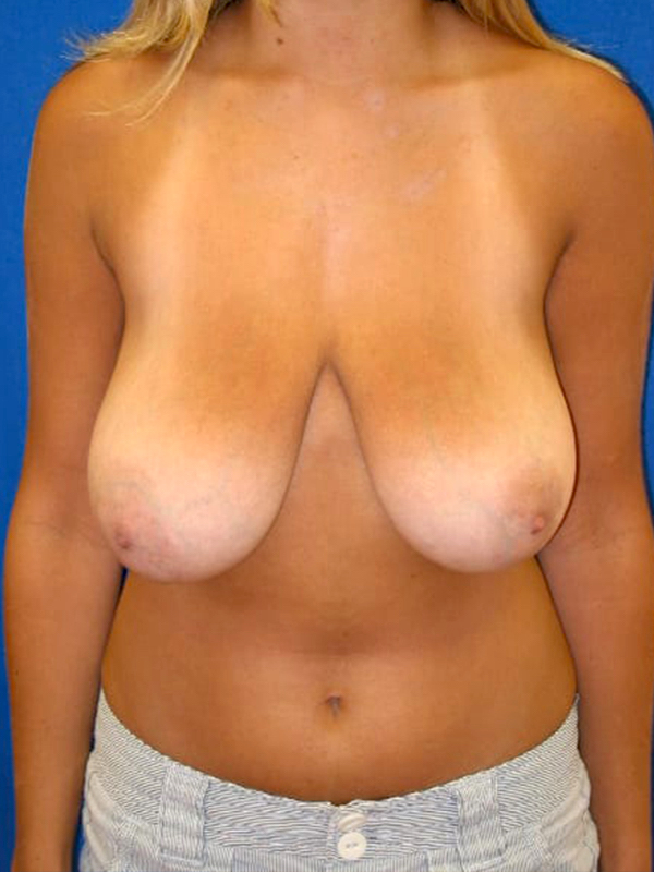  bna image b