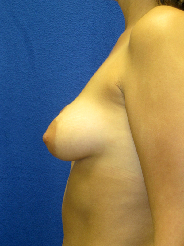  bna image b