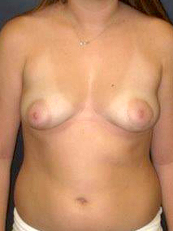 bna image