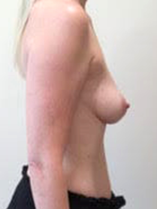  bna image b