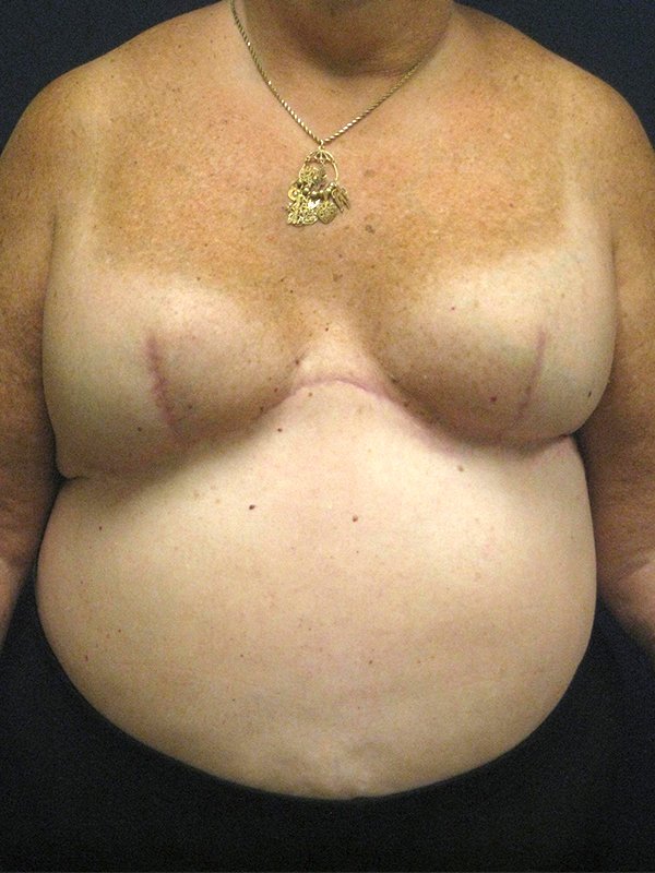 bna image