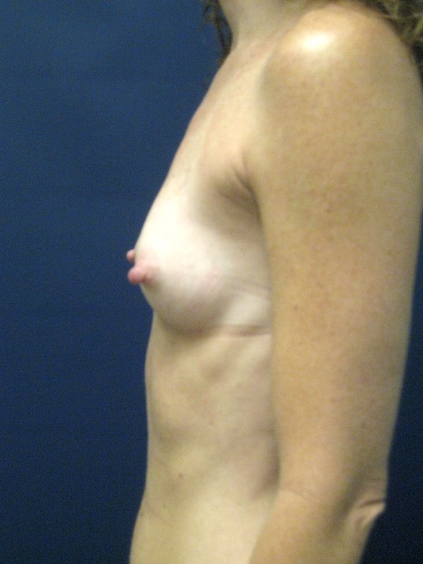  bna image b