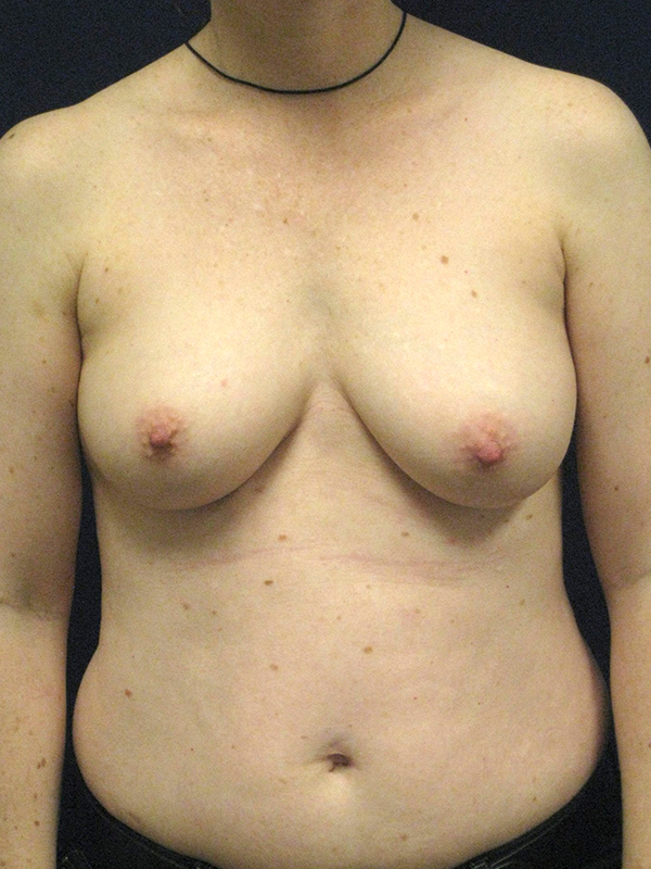  bna image b