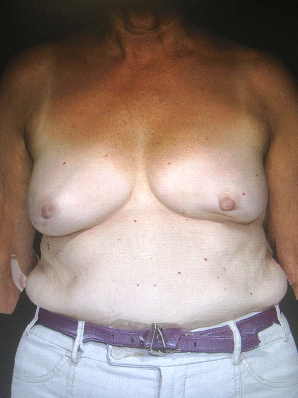  bna image b